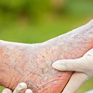 visszer-szovodmenyei