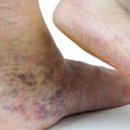 visszerpanaszok-nem-szezonalisak